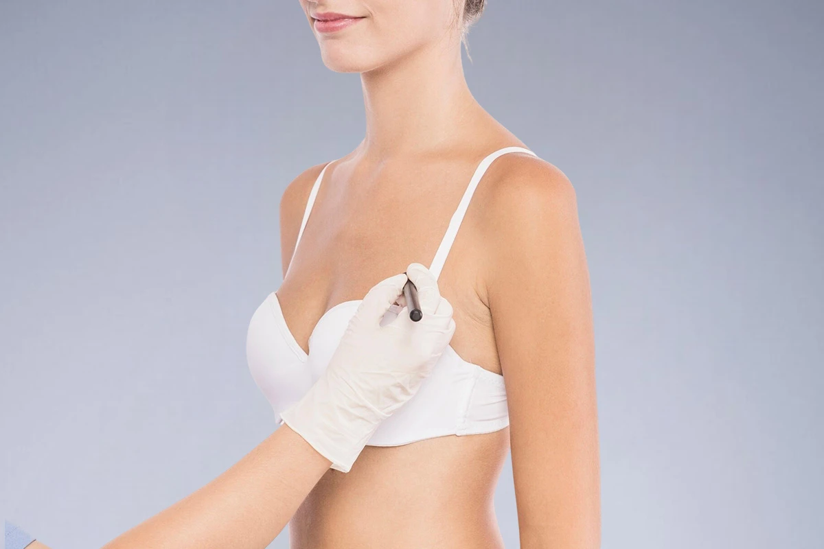 Breast Augmentation