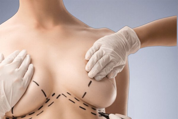 Breast Augmentation Risks