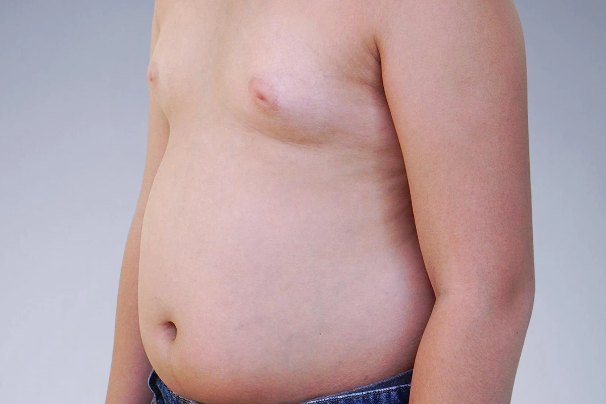 Breast Augmentation Risks