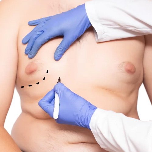 Breast Augmentation Risks