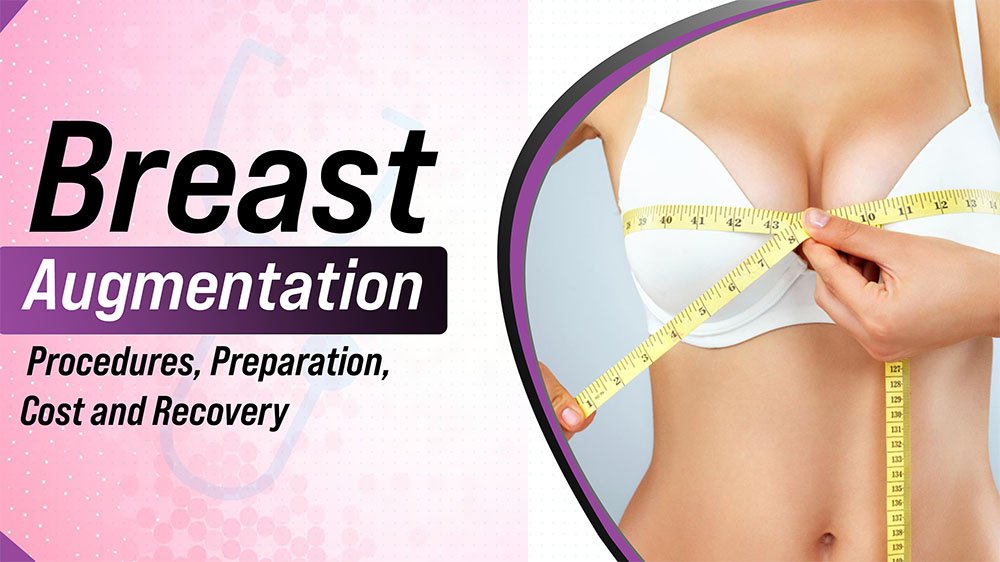 Breast Augmentation 